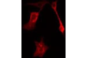 ABIN6277627 staining HeLa cells by IF/ICC. (Plakophilin 2 抗体  (N-Term))