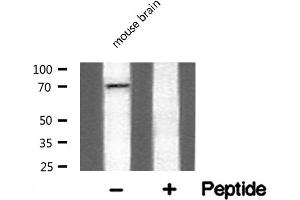 Western blot analysis of Adrenergic Receptor α-2C expression in mouse brain lysate (ADRA2C 抗体  (Internal Region))