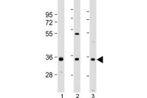 Western blot testing of 1) human 293T/17, 2) mouse brain and 3) human SH-SY5Y cell lysate with NAT8L antibody at 1:2000. (NAT8L 抗体  (AA 59-93))