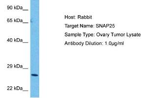 Host:  Rabbit  Target Name:  SNAP25  Sample Tissue:  Human Ovary Tumor  Antibody Dilution:  1ug/ml (SNAP25 抗体  (C-Term))