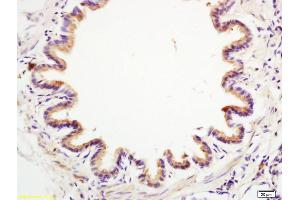 Formalin-fixed and paraffin embedded rat lung labeled with Anti-Anterior Gradient 2 Polyclonal Antibody, Unconjugated (ABIN710021) at 1:200 followed by conjugation to the secondary antibody and DAB staining. (AGR2 抗体  (AA 51-150))