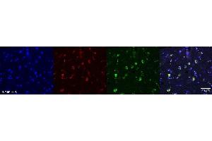 Immunohistochemistry (IHC) image for anti-Oligodendrocytic Myelin Paranodal and Inner Loop Protein (OPALIN) antibody (ABIN7456340) (OPALIN 抗体)