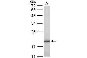 Western Blotting (WB) image for anti-Cofilin 1 (CFL1) antibody (ABIN2855302)