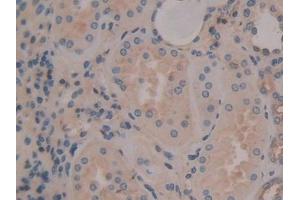 Immunohistochemistry (IHC) image for anti-Annexin A6 (ANXA6) (AA 2-251) antibody (ABIN7434836)
