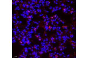Immunofluorescence (Paraffin-embedded Sections) (IF (p)) image for anti-Aldehyde Dehydrogenase 4 Family, Member A1 (ALDH4A1) antibody (ABIN7073000)