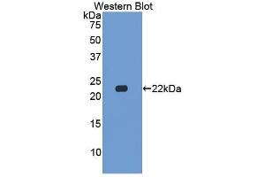 Western Blotting (WB) image for anti-Casein beta (CSN2) (AA 41-198) antibody (ABIN1867412) (CSN2 抗体  (AA 41-198))