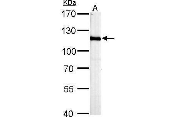 HGS 抗体  (C-Term)