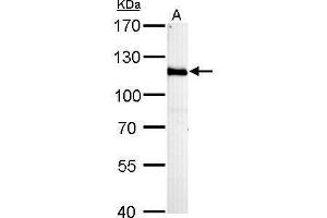 WB Image HGS antibody [C2C3], C-term detects HGS protein by Western blot analysis. (HGS 抗体  (C-Term))