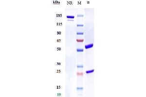 Anti-ILDR2 Reference Antibody (bapotulimab) on SDS-PAGE under reducing (R) condition.