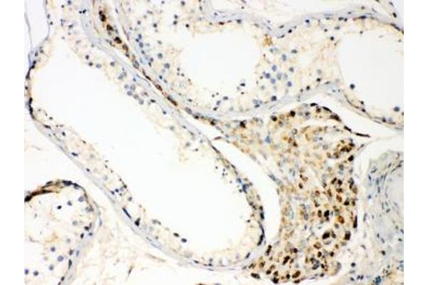 TECTA anticorps  (AA 93-134)
