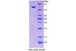 SDS-PAGE analysis of Human SCNN1a Protein. (SCNN1A 蛋白)
