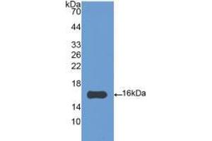 Western blot analysis of recombinant Chicken IL4. (IL-4 抗体  (AA 26-136))