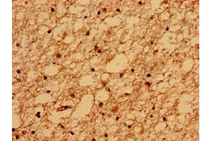 Immunohistochemistry of paraffin-embedded human brain tissue using ABIN7159092 at dilution of 1:100 (TMEM67 抗体  (AA 241-500))