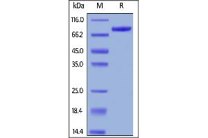 Human CD19 (20-291), Fc Tag, low endotoxin (Super affinity) on  under reducing (R) condition. (CD19 Protein (AA 20-291) (Fc Tag))