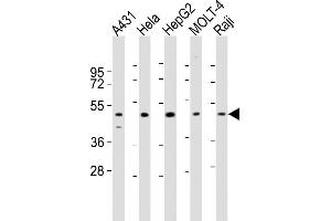 All lanes : Anti-CYP24A1 Antibody (N-term) at 1:2000 dilution Lane 1: A431 whole cell lysates Lane 2: Hela whole cell lysates Lane 3: HepG2 whole cell lysates Lane 4: MOLT-4 whole cell lysates Lane 5: Raji whole cell lysates Lysates/proteins at 20 μg per lane. (CYP24A1 抗体  (N-Term))