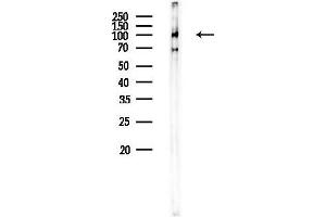 anti-Glutamate Receptor, Ionotropic, AMPA 2/3 (GRIA2/3) (C-Term) antibody