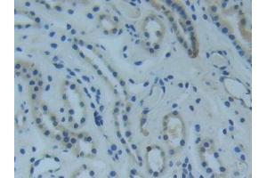 Immunohistochemistry (IHC) image for anti-Raftlin, Lipid Raft Linker 1 (RFTN1) (AA 288-520) antibody (ABIN7442279)