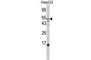 Western Blotting (WB) image for anti-Fucosidase, alpha-L- 1, Tissue (FUCA1) antibody (ABIN3002802)