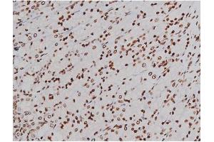 Immunohistochemistry (IHC) image for anti-Mast/stem Cell Growth Factor Receptor (KIT) (pTyr721) antibody (ABIN6256004)