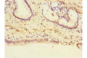 Immunohistochemistry of paraffin-embedded human pancreatic tissue using ABIN7174111 at dilution of 1:100 (PTPN4 抗体  (AA 1-240))