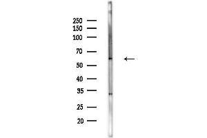 Western blot analysis of lysates from MCF7 cells(heat-shock,45 min treatment), using Fukutin Antibody at 1/1000 dilution.