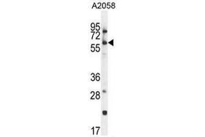 CCDC148 Antibody (Center) western blot analysis in A2058 cell line lysates (35µg/lane). (CCDC148 抗体  (Middle Region))