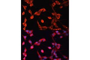 Immunofluorescence analysis of NIH-3T3 cells using  Polyclonal Antibody (ABIN6129875, ABIN6136541, ABIN6136542 and ABIN6224558) at dilution of 1:100 (40x lens). (ADAMTS13 抗体  (AA 1300-1400))