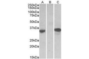 HEK293 lysate (10µg protein in RIPA buffer) over expressing Human CMA1 with DYKDDDDK tag probed with this antibody (0. (CMA1 抗体  (Internal Region))