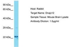 Image no. 1 for anti-DnaJ (Hsp40) Homolog, Subfamily C, Member 12 (DNAJC12) (AA 31-80) antibody (ABIN6750387) (DNAJC12 抗体  (AA 31-80))