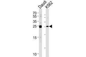 Western Blotting (WB) image for anti-MOB Kinase Activator 1B (MOB1B) antibody (ABIN3002948) (MOBKL1A 抗体)