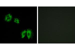 Peptide - +Immunohistochemistry analysis of paraffin-embedded human heart tissue using B3GALT2 antibody. (B3GALT2 抗体)