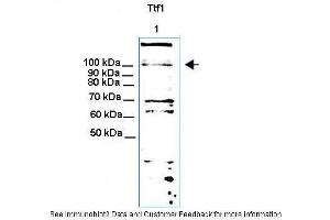 Lanes:  30ug NIH3T3 cell lysate Primary Antibody Dilution:  1:1000 Secondary Antibody:  Anti-rabbit HRP Secondary Antibody Dilution:  1: 5000 Gene Name:  Ttf1 Submitted by:  Thomas Moss (TTF1 抗体  (N-Term))