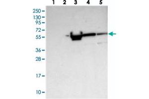 Western blot analysis of Lane 1: RT-4, Lane 2: U-251 MG, Lane 3: Human Plasma, Lane 4: Liver, Lane 5: Tonsil with ALKBH8 polyclonal antibody  at 1:250-1:500 dilution. (ALKBH8 抗体)