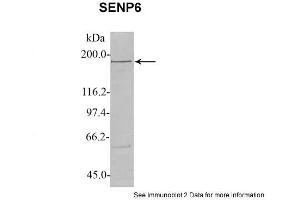 Sample Type: 1. (SENP6 抗体  (C-Term))