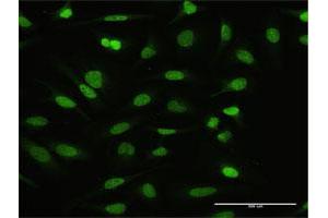 Immunofluorescence of purified MaxPab antibody to NFATC2IP on HeLa cell. (NFATC2IP 抗体  (AA 1-138))