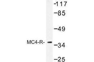 Image no. 1 for anti-Melanocortin 4 Receptor (MC4R) antibody (ABIN317754) (MC4R 抗体)
