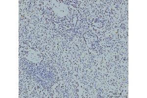 IHC analysis of RPA32/RPA2 using anti-RPA32/RPA2 antibody (ABIN7601379). (RPA2 抗体  (AA 34-254))