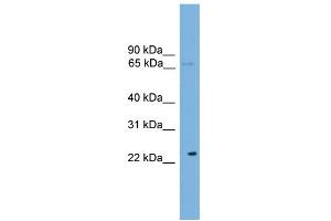 WB Suggested Anti-CALCOCO1 Antibody Titration: 0. (CALCOCO1 抗体  (N-Term))