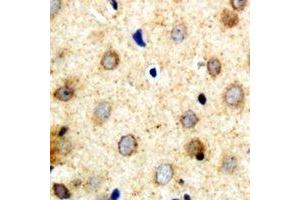 Immunohistochemical analysis of SAR1B staining in human brain formalin fixed paraffin embedded tissue section. (SAR1B 抗体)