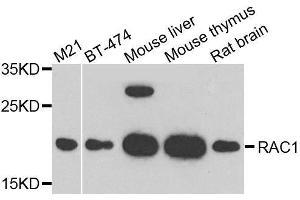 RAC1 抗体  (AA 1-192)