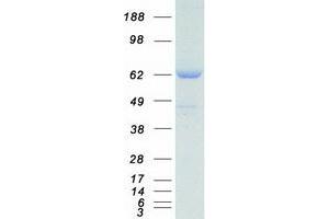 Western Blotting (WB) image for Sorting Nexin 2 (SNX2) protein (Myc-DYKDDDDK Tag) (ABIN2732400)