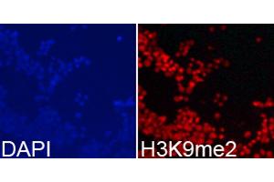 Immunofluorescence (IF) image for anti-Histone 3 (H3) (H3K9me2) antibody (ABIN3023260)