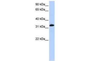 Image no. 1 for anti-Cardiac Troponin T (cTnT) (AA 72-121) antibody (ABIN6743074) (Cardiac Troponin T2 抗体  (AA 72-121))