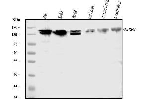 Western blot analysis of ATX2/ATXN2 using anti-ATX2/ATXN2 antibody (ABIN3043507). (Ataxin 2 抗体  (C-Term))