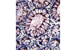 PIGR Antibody immunohistochemistry analysis in formalin fixed and paraffin embedded human colon tissue followed by peroxidase conjugation of the secondary antibody and DAB staining. (Stathmin 1 抗体  (C-Term))