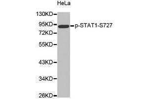 Western blot analysis of extracts from Hela cells, using Phospho-STAT1-S727 antibody. (STAT1 抗体  (pSer727))