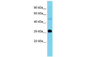 Host:  Rabbit  Target Name:  Mxi1  Sample Type:  Mouse Muscle lysates  Antibody Dilution:  1. (MXI1 抗体  (N-Term))