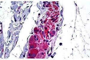 Human Intestine, Ganglion Cells: Formalin-Fixed, Paraffin-Embedded (FFPE) (HDAC6 抗体  (AA 7-56))
