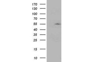 Western Blotting (WB) image for anti-Activating Signal Cointegrator 1 Complex Subunit 1 (ASCC1) antibody (ABIN1496741) (ASCC1 抗体)