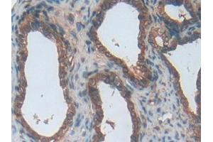 Used in DAB staining on fromalin fixed paraffin- embedded stomach tissue (ENPP1 抗体  (AA 568-793))